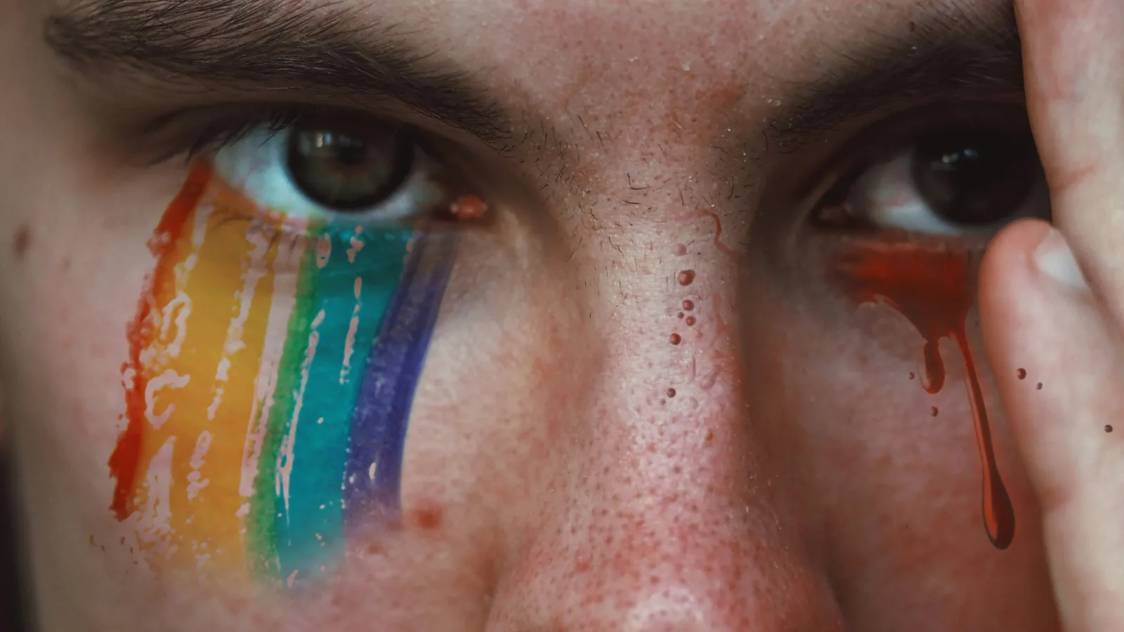 Homophobic Attack